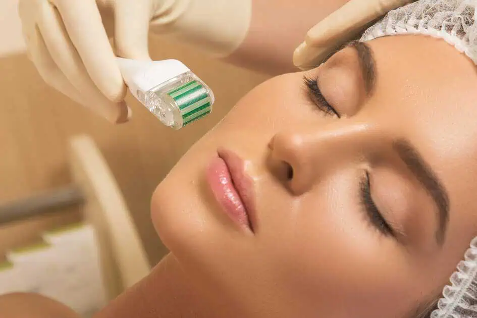 Benefits of Microneedling by Drippy Nurse Jess in Gilroy, CA