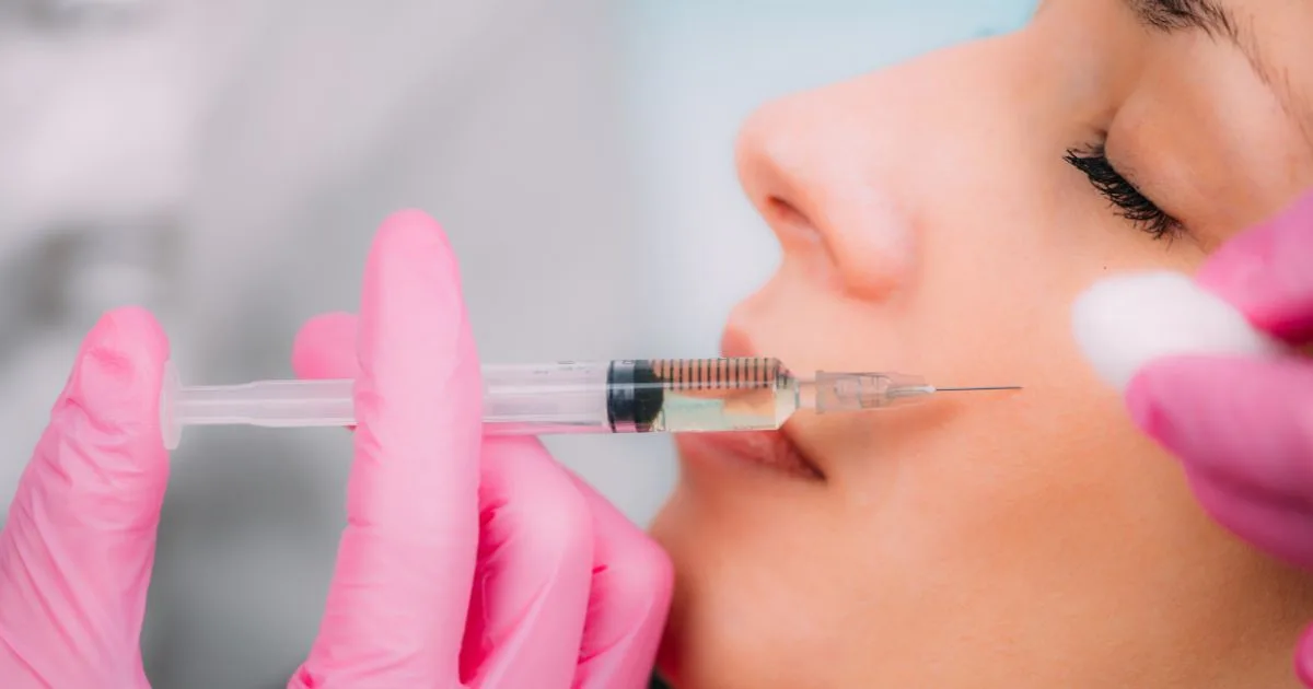 Dermal filler treatment session in progress, demonstrating the precise injection method used for customizable results.