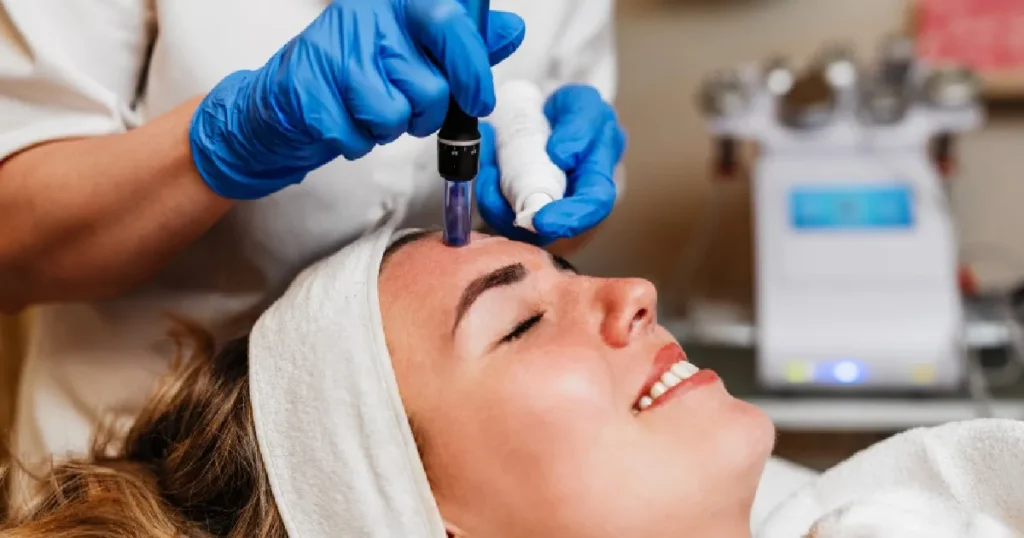 Women receiving Microneedling in Gilroy, CA