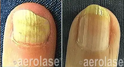 Nails