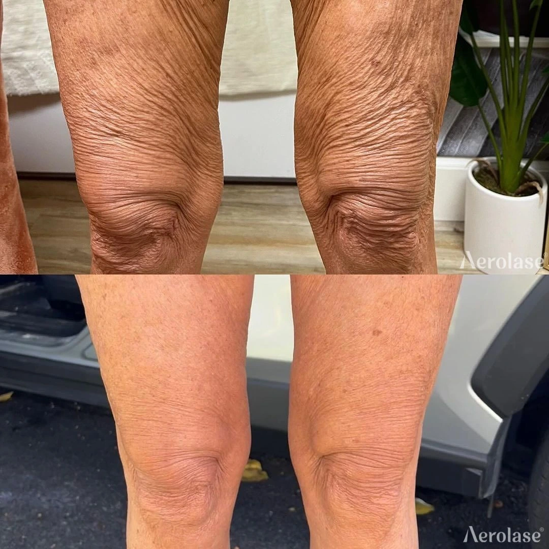Skin Rejuvenation - Photos courtesy of The Goddess Aesthetics