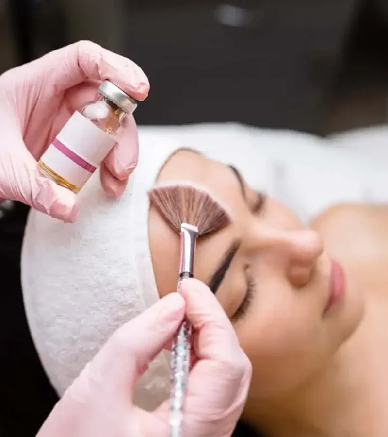 VI-Chemical-Peels-in-Gilroy-CA