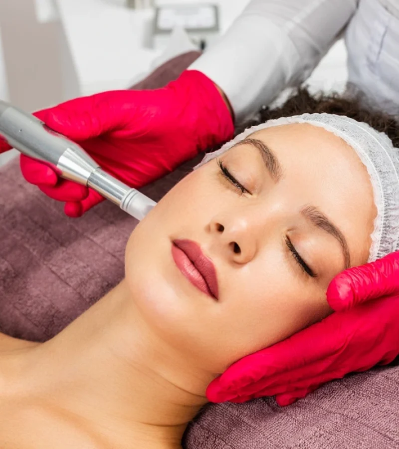 microneedling-with-prp-in-gilroy-ca